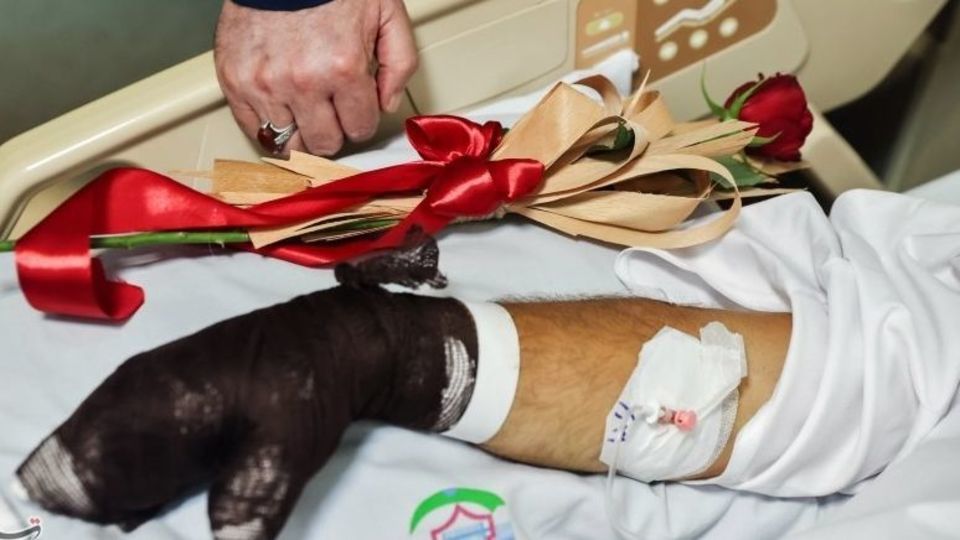 بازنگری فاجعه بندر عباس از منظر سلامت فراتر از آتش و دود