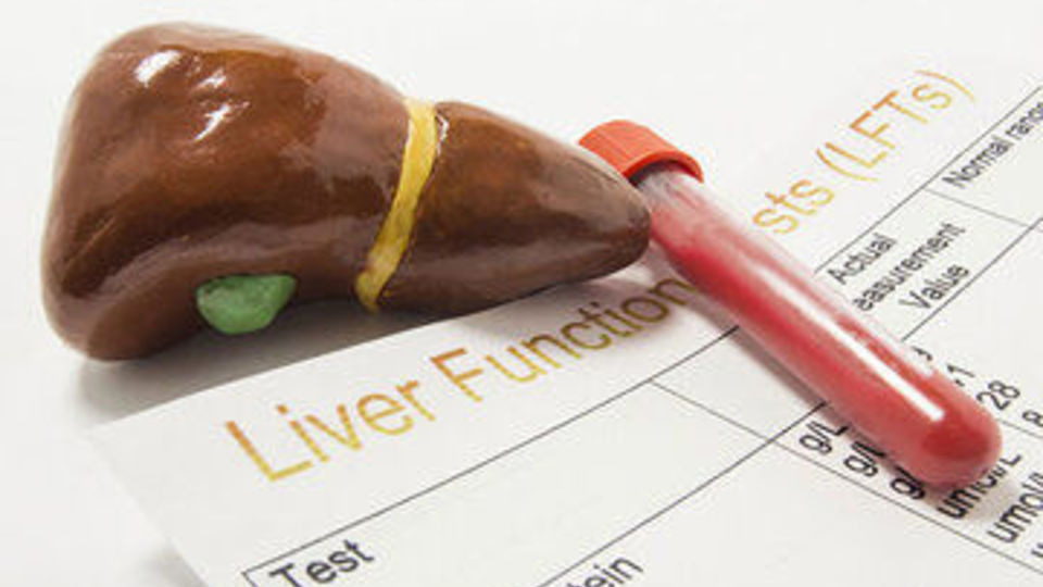 علت بالا رفتن آنزیم‌های کبدی چیست؟/ باید مراقب چه علائمی باشیم